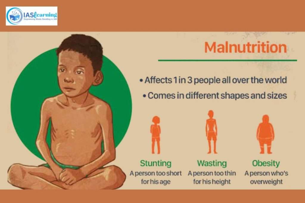 Malnutrition